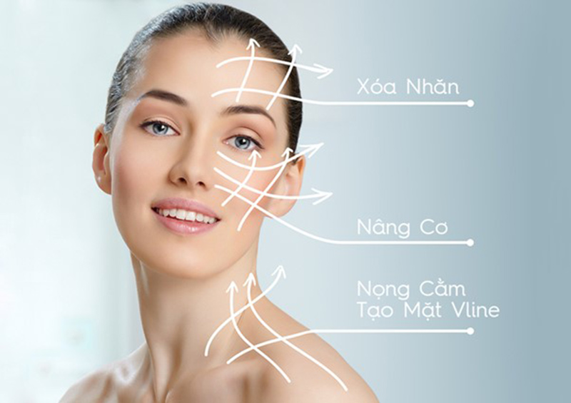 Căng da mặt bằng chỉ là phương pháp được nhiều chị em lựa chọn