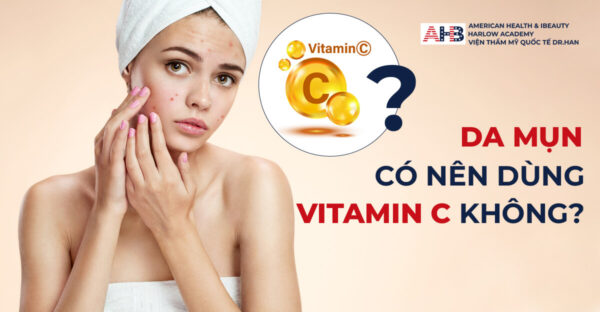 Chuyên gia giải đáp: Da mụn dùng Vitamin C được không?