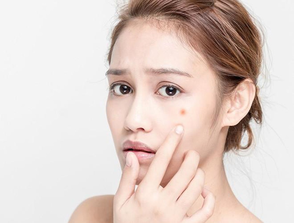 Việc chạm tay vào da mặt có thể khiến nốt mụn hình thành vết thâm hoặc sẹo