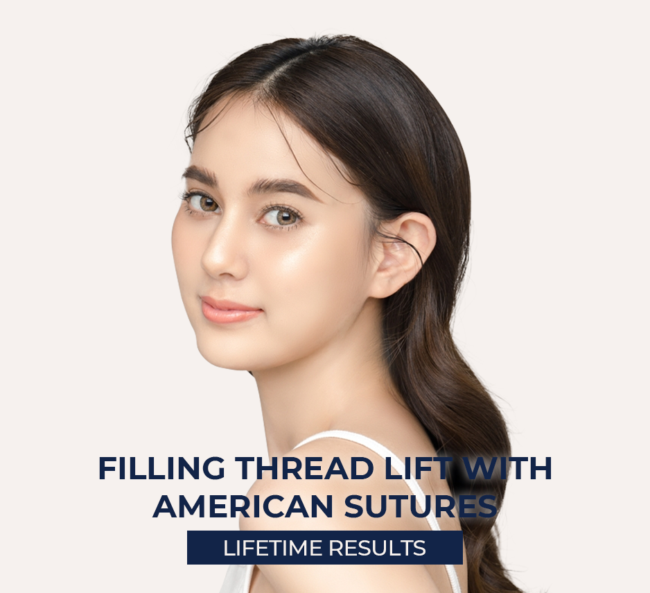 Filling Thread Lift Using American Sutures