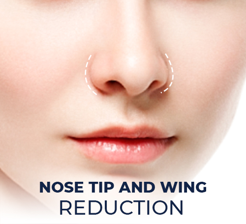 Nose tip and wing reduction