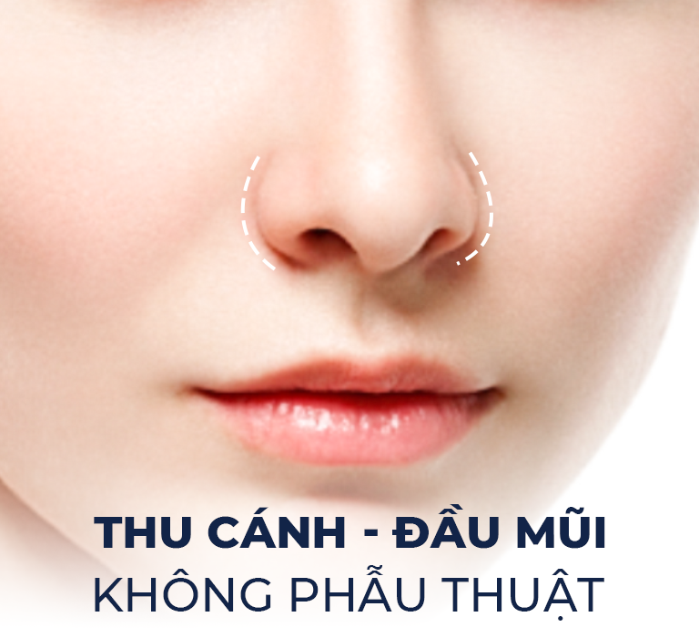 Thu Cánh – Đầu Mũi Không Phẫu Thuật