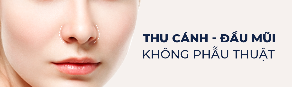 Thu Cánh – Đầu Mũi Không Phẫu Thuật